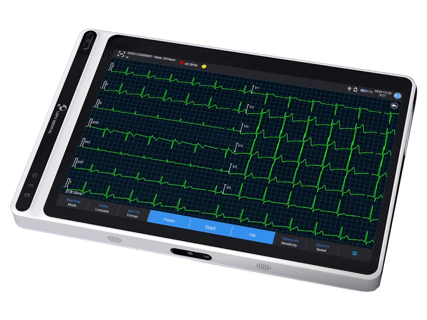 [54230] NEO ECG S120 TABLET ECG - CONNETTORE BANANA
